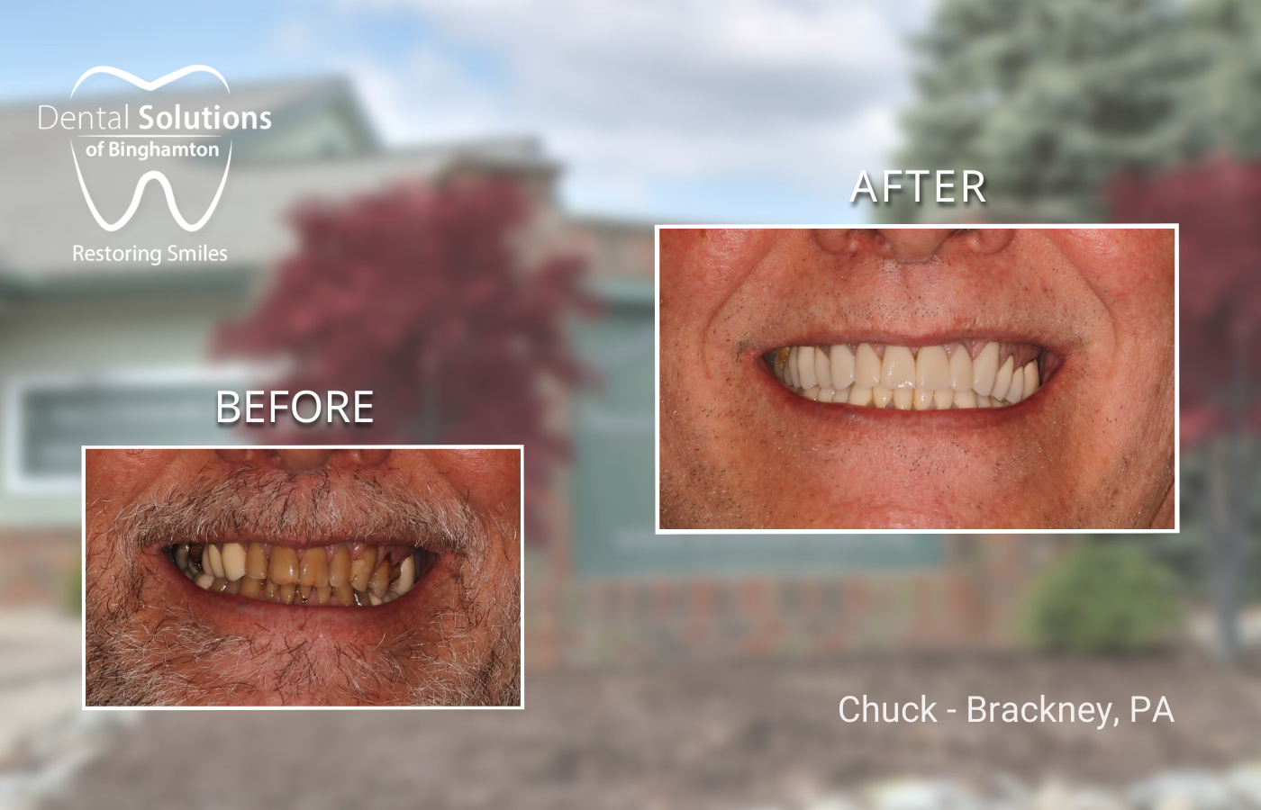 Chuck - Brackney, PA