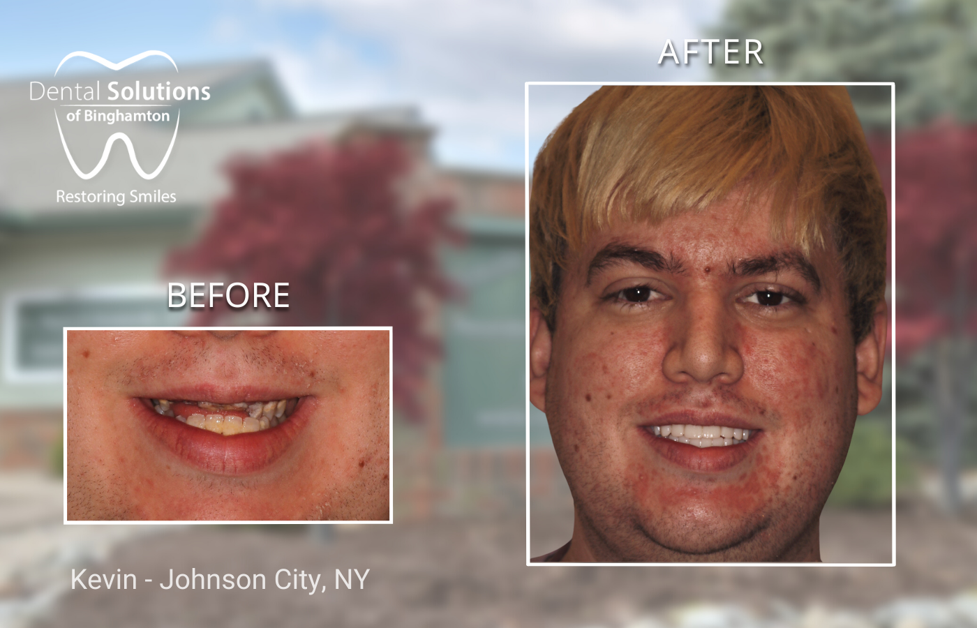 Kevin - Johnson City, NY